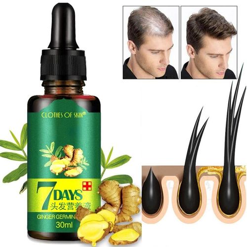 Derma Roller + Ginger Hair Growth Oil (2 in 1)